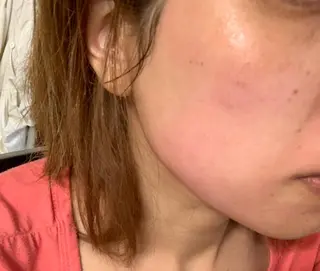 エステティック Nanagiのエステ・リラクイメージ