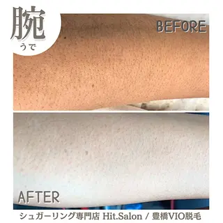 Hit. シュガーリング豊橋のエステ・リラクイメージ