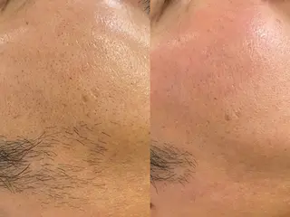 Morphome所属・【Morphome】 hinaのエステ・リラクイメージ