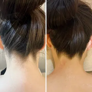 うなじ脱毛/美肌脱毛 LABELのエステ・リラクイメージ