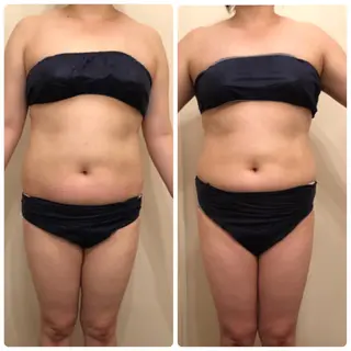 FLEUR大阪・美容 整体・痩身・小顔のエステ・リラクイメージ