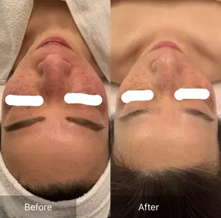 セミロング カラー パーマ ヘアアレンジ メンズ キッズ ネイル マツエク・マツパ アイブロウ ハーブピーリング✨ 🌿最強痩身🔥のエステ・リラクイメージ