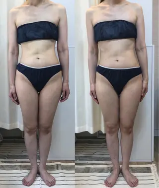 脱毛｜肌質改善｜ ROOM.Sのエステ・リラクイメージ