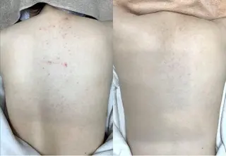 salon tiamのマツエク・マツパデザイン