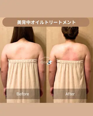 【頭痛、睡眠改善】 salon RUUのエステ・リラクイメージ