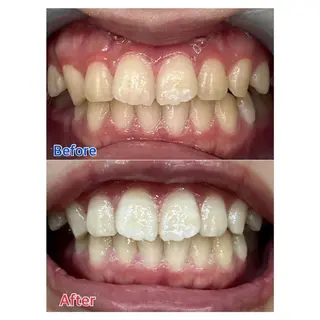 MBEAUTYSALON 千葉店・京成大久保所属・Melty 輝のその他イメージ