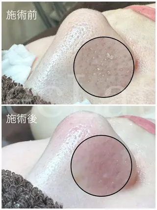 岩本 麻那のマツエク・マツパデザイン