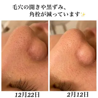 Bellesthe (ベルエステ)のエステ・リラクイメージ