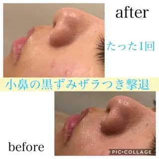 ミディアム カラー パーマ ヘアアレンジ キッズ ネイル マツエク・マツパ Ensor Clair所属・EnsorClair 代表 野口真央のエステ・リラクイメージ