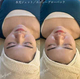 うなじ脱毛/美肌脱毛 LABELのエステ・リラクイメージ