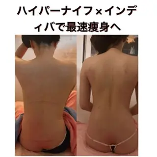 【ハイパーナイフ痩身&小顔コルギ&ハーブピーリング】K-Beauty　東新宿所属・kーbeauty痩身 フェイシャルのエステ・リラクイメージ