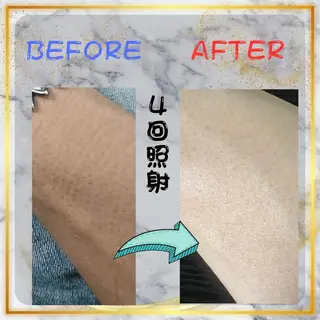 メンズ キッズ メンズ脱毛 FELISSE【フェリッセ】所属・メンズ脱毛フェリッセ /男女🆗キッズ🆗のエステ・リラクイメージ