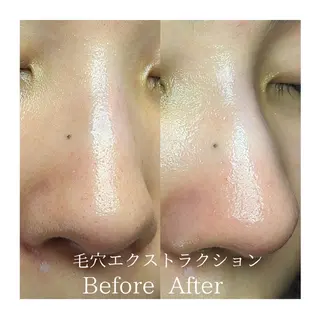  毛穴洗浄・まつ毛 の専門店 ソラーレのエステ・リラクイメージ