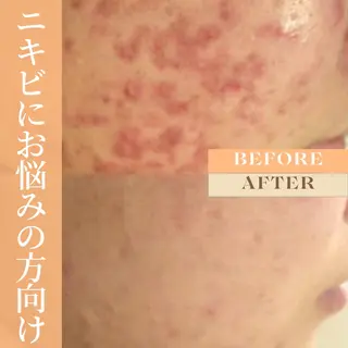 肌弱くてもOK！敏感 肌さんのためのサロンのエステ・リラクイメージ
