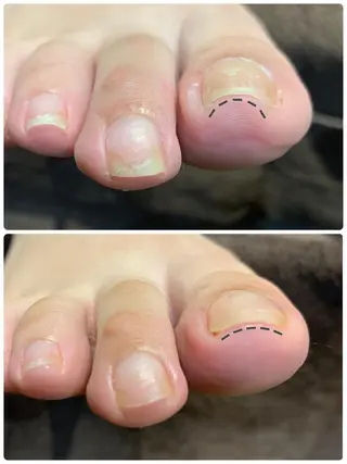 ネイル N.barber / koderaのネイルデザイン