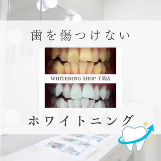 メンズ ホワイトニング ショップ千葉店のその他イメージ