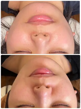 FLEUR大阪・整体 ・ハイフ・痩身・小顔のエステ・リラクイメージ