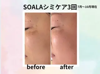 美容整体師  江上のエステ・リラクイメージ