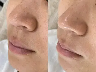 Salon de Galcon 2階(サロンド・ギャルソン)所属・KU TA  \(◡̈)/のエステ・リラクイメージ