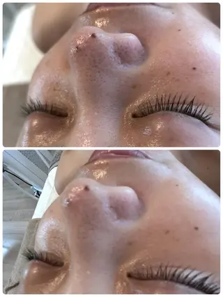 Beauty salon Wish所属・脱毛🌈肌質改善🌈 Wishのエステ・リラクイメージ