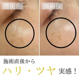 ハーブピーリング・毛穴ケア専門サロンSalon de LENA所属・ハーブピーリング 専門店/名古屋駅前店のエステ・リラクイメージ