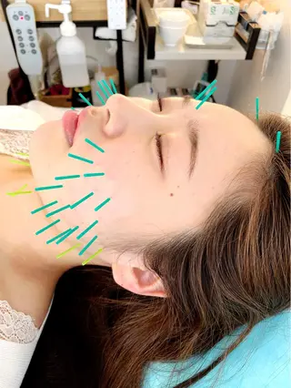 小顔美容鍼専門サロン 渋谷YZのエステ・リラクイメージ