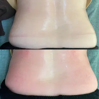 VERY VERY九条店所属・ベリーベリー🌹 九条店のエステ・リラクイメージ