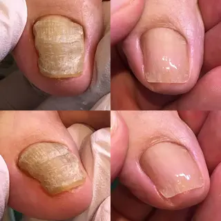 東京巻き爪アカデミー所属・東京巻き爪 アカデミーのエステ・リラクイメージ