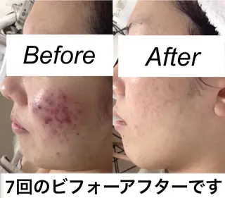 都度払い肌質改善 &脱毛Blancheのエステ・リラクイメージ