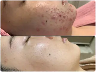 フェイシャル/脱毛 ジョアアンジェ　田中のエステ・リラクイメージ