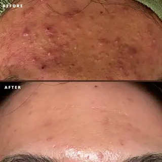 ニキビ改善専門店 d'Albaのエステ・リラクイメージ