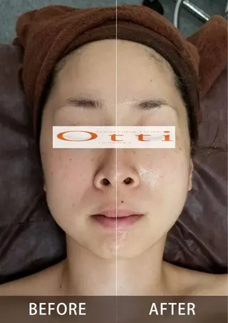 エステ脱毛サロン Otti  オッティのエステ・リラクイメージ