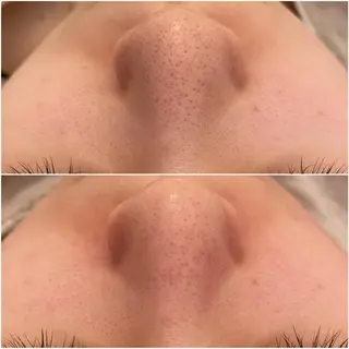 ✨美肌水光✨ アトリエリュバンのエステ・リラクイメージ