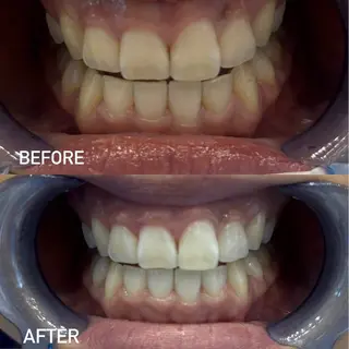 ホワイトニングサロンaile所属・セルフホワイトニング 金城しおりのその他イメージ