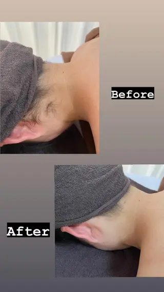 都度払い制脱毛サロンBe Charm所属・Be Charm 山﨑のエステ・リラクイメージ