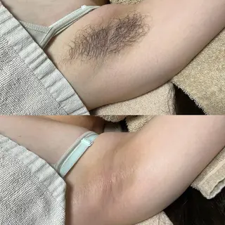 脱毛サロンBloom所属・脱毛屋さん/池袋 /Bloom🍋わだのエステ・リラクイメージ