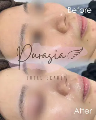 🪞Purasia. 🫧韓国肌管理💎のエステ・リラクイメージ