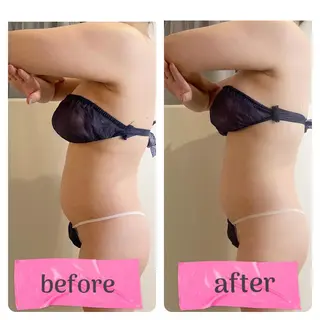 インディバサロン LILY  新宿御苑のエステ・リラクイメージ