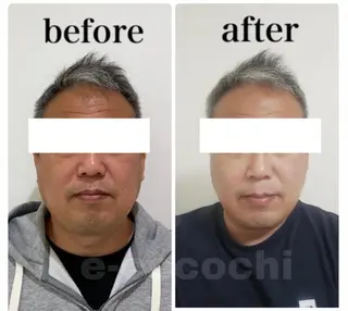 小顔と ヘッドスパのお店のエステ・リラクイメージ