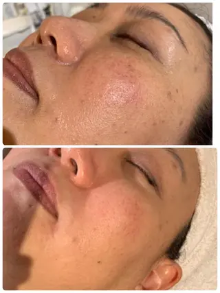 esty hitomiのエステ・リラクイメージ