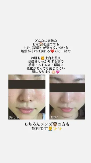 hair design shu所属・頭皮とお肌をきれいに 大名店🖤Shuのエステ・リラクイメージ