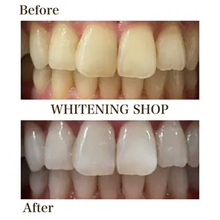 ホワイトニングショップ静岡葵区店所属・ホワイトニング ショップ静岡葵区店のその他イメージ