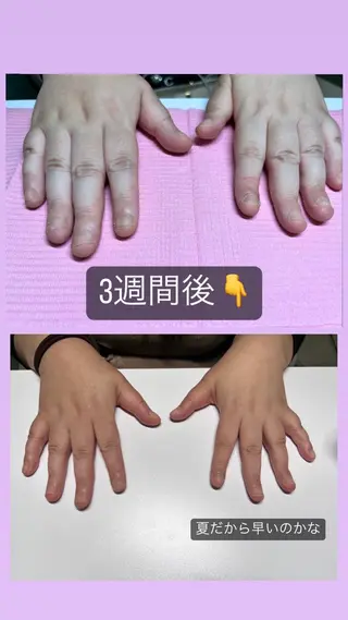 メンズ ネイル 爪ケア/深爪 自爪育成 🐰えむのネイルデザイン