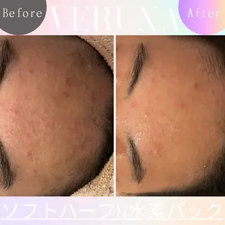 ニキビ改善専門店 d'Albaのエステ・リラクイメージ