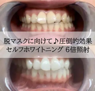 ホワイトニング専門店 LCS 銀座店 峰岡のその他イメージ