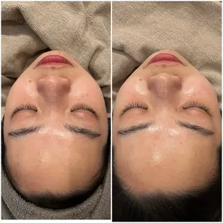 yellow.所属・yellow💛【 脱毛&フェイシャル】のエステ・リラクイメージ