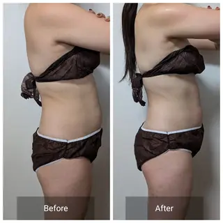 nail RiRi アトレナチュラのエステ・リラクイメージ