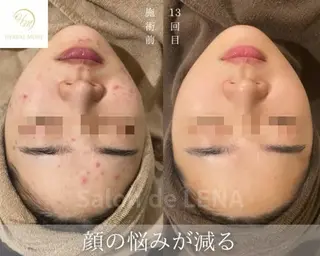 ハーブピーリング・毛穴ケア専門サロンSalon de LENA 栄店所属・ハーブピーリング専門 サロンドレナ　白藤のエステ・リラクイメージ