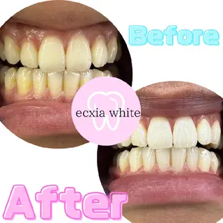 エクシアホワイトニング草津店所属・エクシア ホワイトニング草津店のその他イメージ