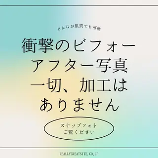 肌弱くてもOK！敏感 肌さんのためのサロンのエステ・リラクイメージ